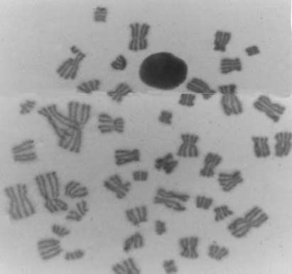 Endoreduplicated cell from a V79 cell line treated with the catechol derivative 15 of lignan a-conidendrin at 500 mM.